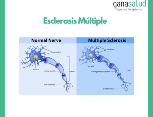 Esclerosis Múltiple y ejercicio
